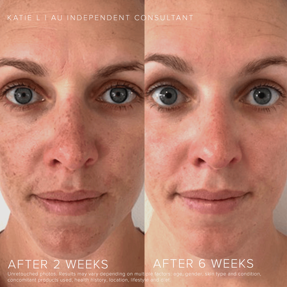 Reverse Regimen for Brightening Discoloured Skin | Rodan + Fields® CA