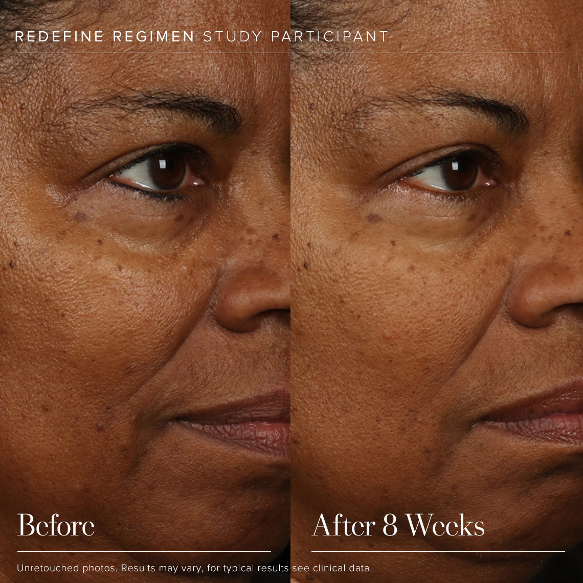 REDEFINE Age Assault Special