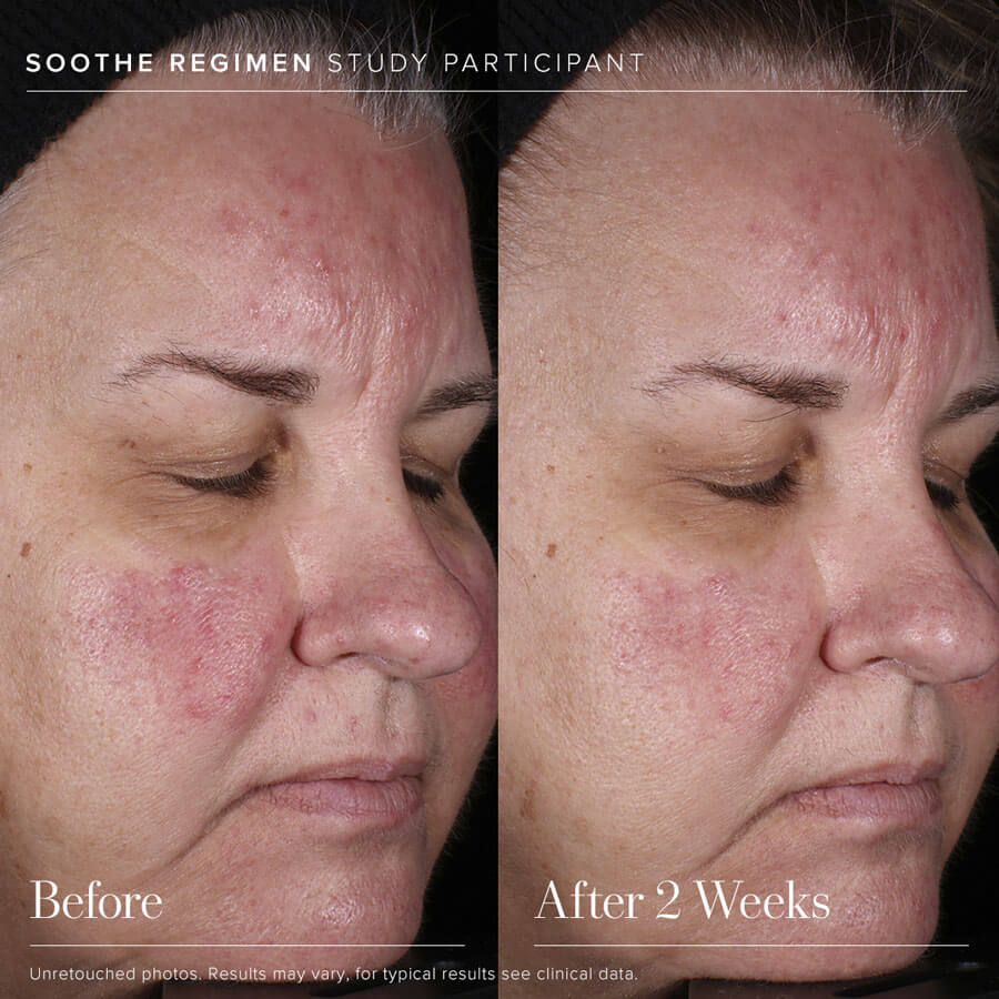 SOOTHE Moisturizing Rescue Cream
