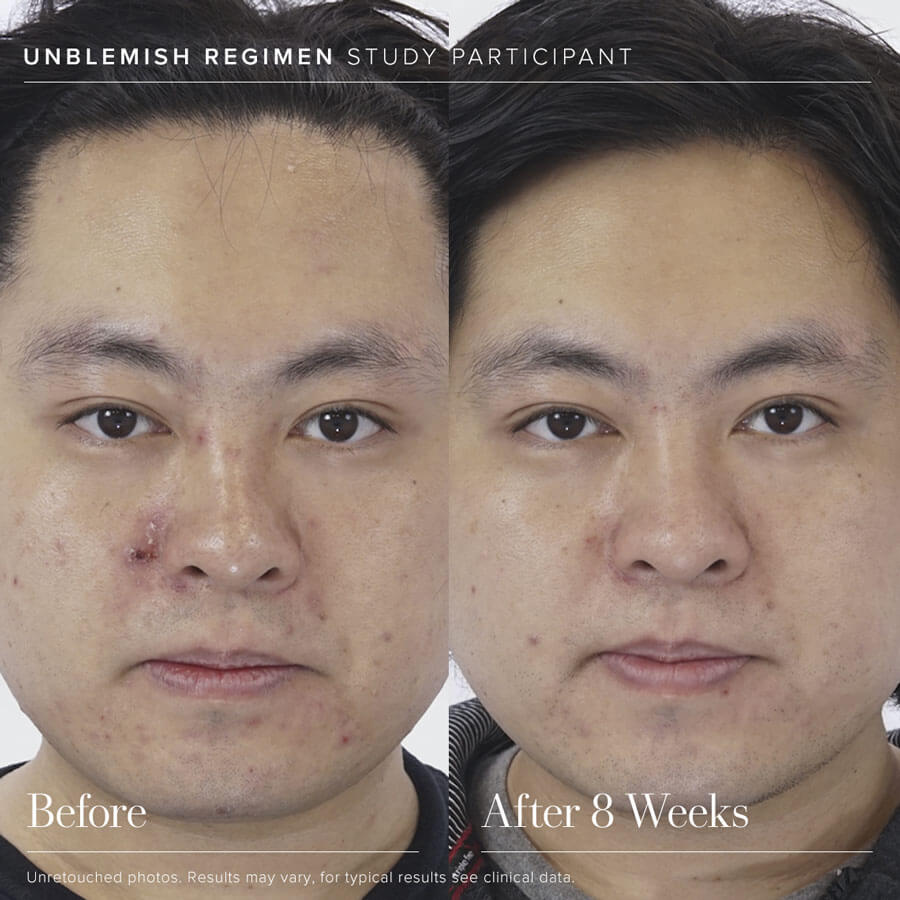 UNBLEMISH Invisible Matte Defense Broad Spectrum SPF 30